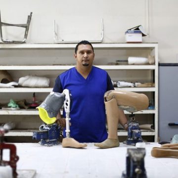 Prótesis hechas en El Salvador: una nueva oportunidad para lisiados de guerra o accidentes