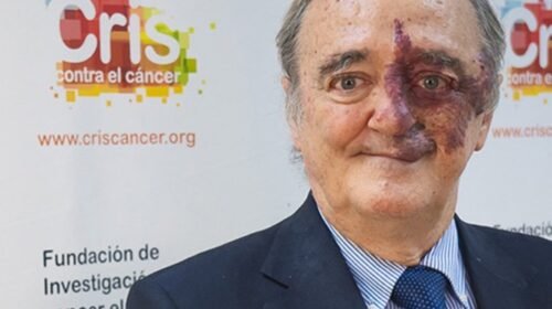 Mariano Barbacid cura cancer pancrear enfermedad