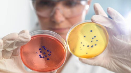 bacterias edomex muerte menores brote salud