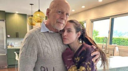 bruce willias demencia diagnostico