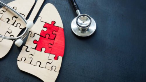 dia cancer de pulmon mexico enfermedades salud