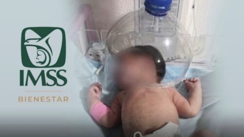 recien nacido tabasco