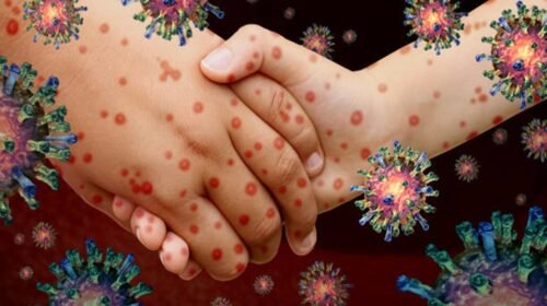 sarampion contagios muertes cdmx