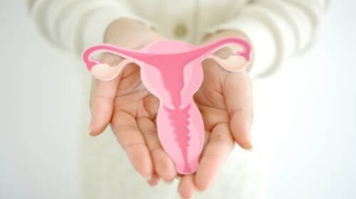 sindrome ovario poliquístico cambio nombre salud reproductiva
