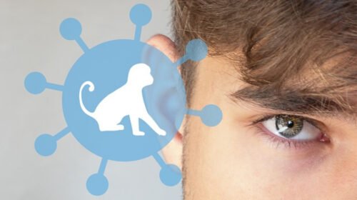 viruela mono mexico declaracion emergencia sanitaria mundial