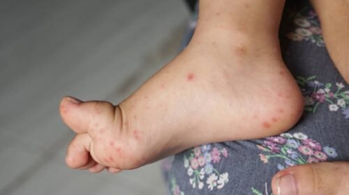 virus contagios escuelas sep puebla suspension de clases